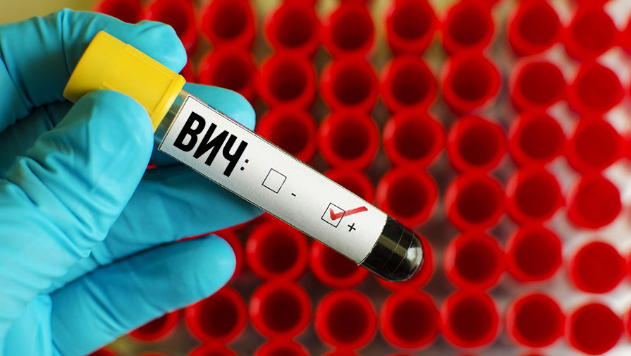 Что такое ВИЧ-инфекция, и чем она отличается от СПИДа? Что такое ВИЧ-инфекция, и чем она отличается от СПИДа?